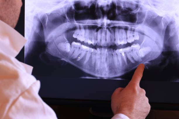 Best Emergency Treatment for Toothache in Kings Park West, VA